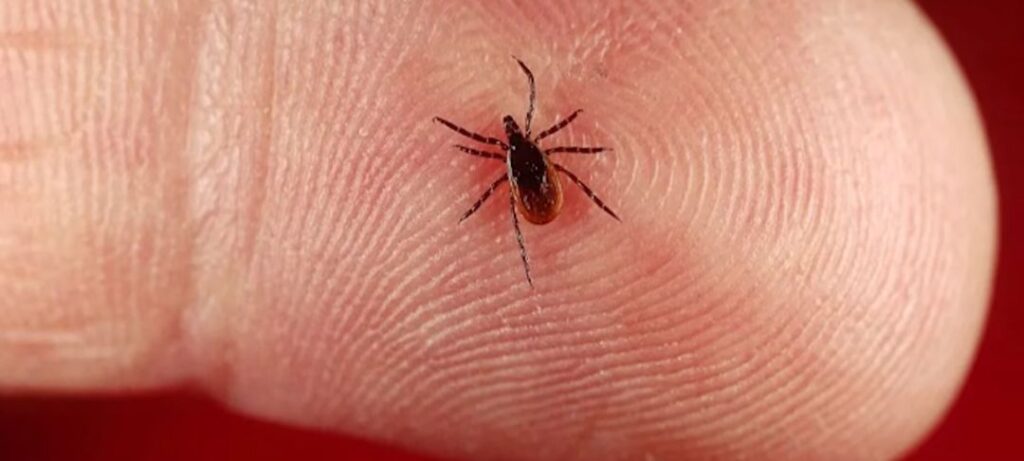 केरल में नई बीमारी Lyme Disease क्या है? Lyme Disease in Keral