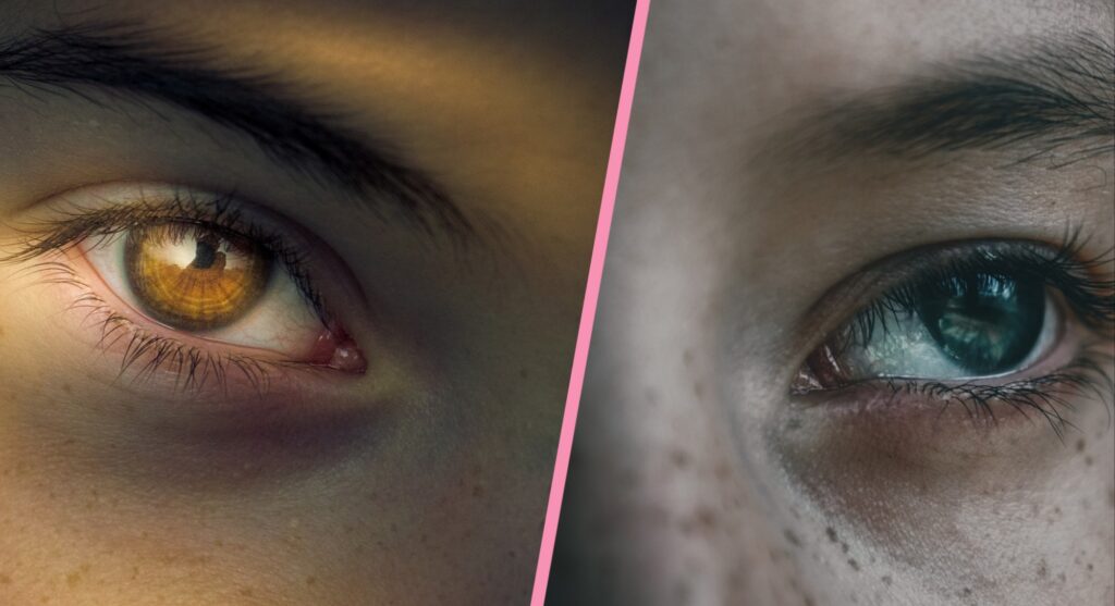 Dark Circles को करें जड़ से खत्म, जानें आसान तरीका